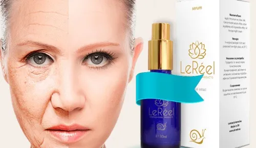 Elesse cream : gdje kupiti u Hrvatskoj, u ljekarni?
