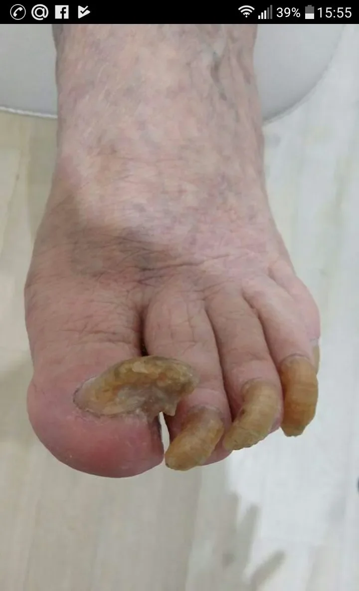 Exofeet oil : sastav samo prirodni sastojci.